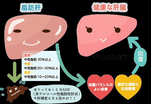 脂肪肝の症状